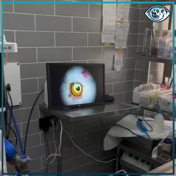 Lamellar Keratektomi ile Korneal Sekestrum Tedavisi